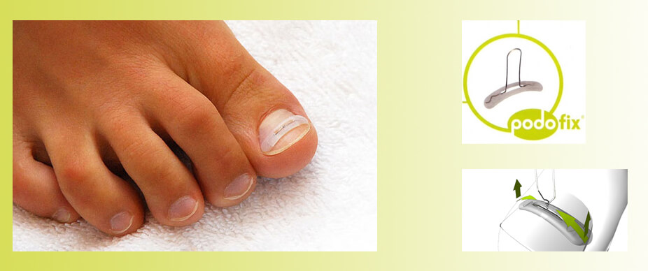 Pedicure-Podofix-plakbeugel